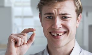 Có nhiều lý do dẫn đến giấc mơ thấy bị gãy răng